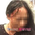 3名广西游客南非旅游遭劫匪枪击 一对母女头部中枪