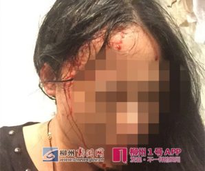 3名广西游客南非旅游遭劫匪枪击 一对母女头部中枪