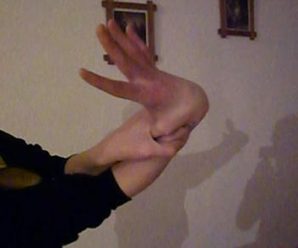 牛人！荷兰男子手掌360度旋转无压力