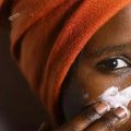 非洲的美白产业：黑人女子为变美将脸漂白