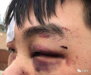 中国留学生在澳洲被围殴打伤 打人者喊“滚回中国”