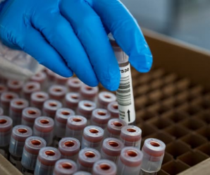 美国加州确诊5例“双突变”变异新冠病毒