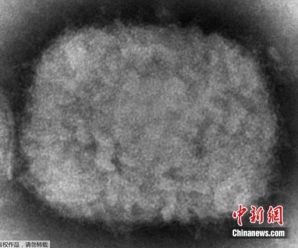 世卫：猴痘病毒已发生人际传播 未来或发现更多病例