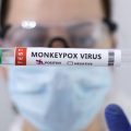 美国猴痘疫情严峻：超9000人感染 单日新增1400多例创新高